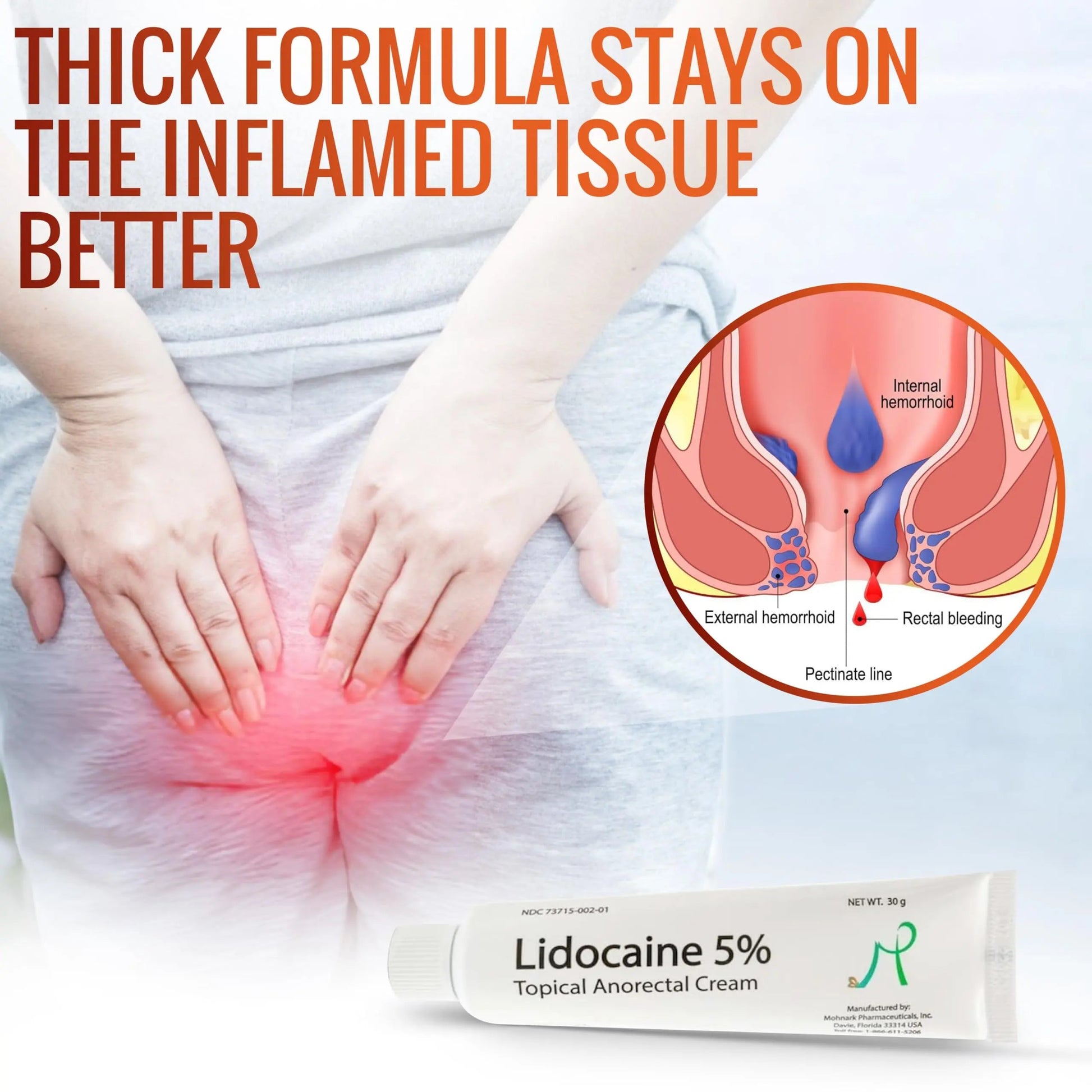 Mohnark Maximum Strength Lidocaine Hemorrhoid Treatment Cream for External and Internal Hemorrhoids Treatment Burn Itch Pain Relief Anal Cream Topical Anorectal Numbing Cream- 30 Gram Tube Made in USA MOHNARK Au supplements