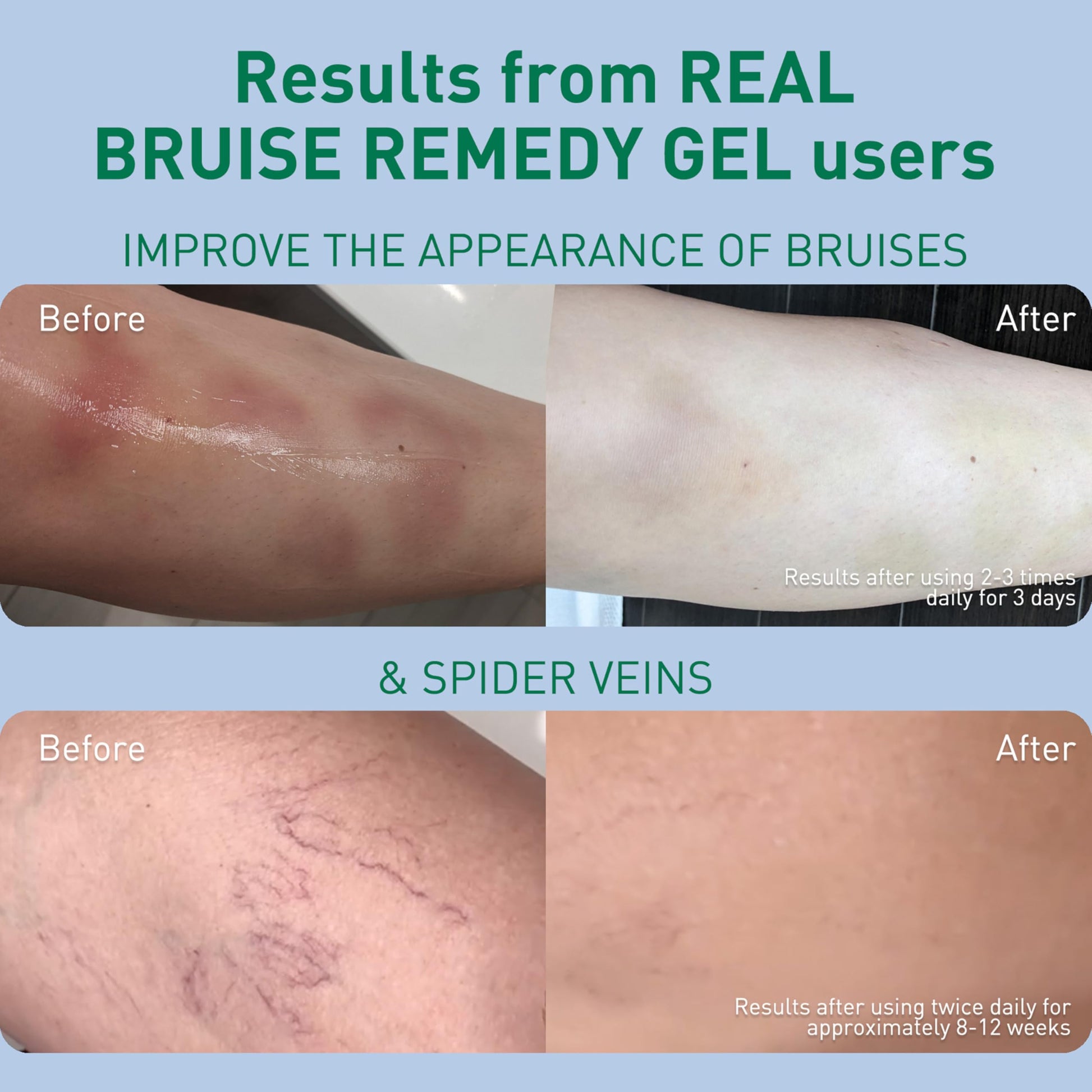 PROcure Arnica & MSM Bruise Remedy Gel – Paraben-Free, Unscented Arnica Montana Gel for Bruising, Spider Veins & Skin Discoloration – 2 Pack PROcure Au supplements