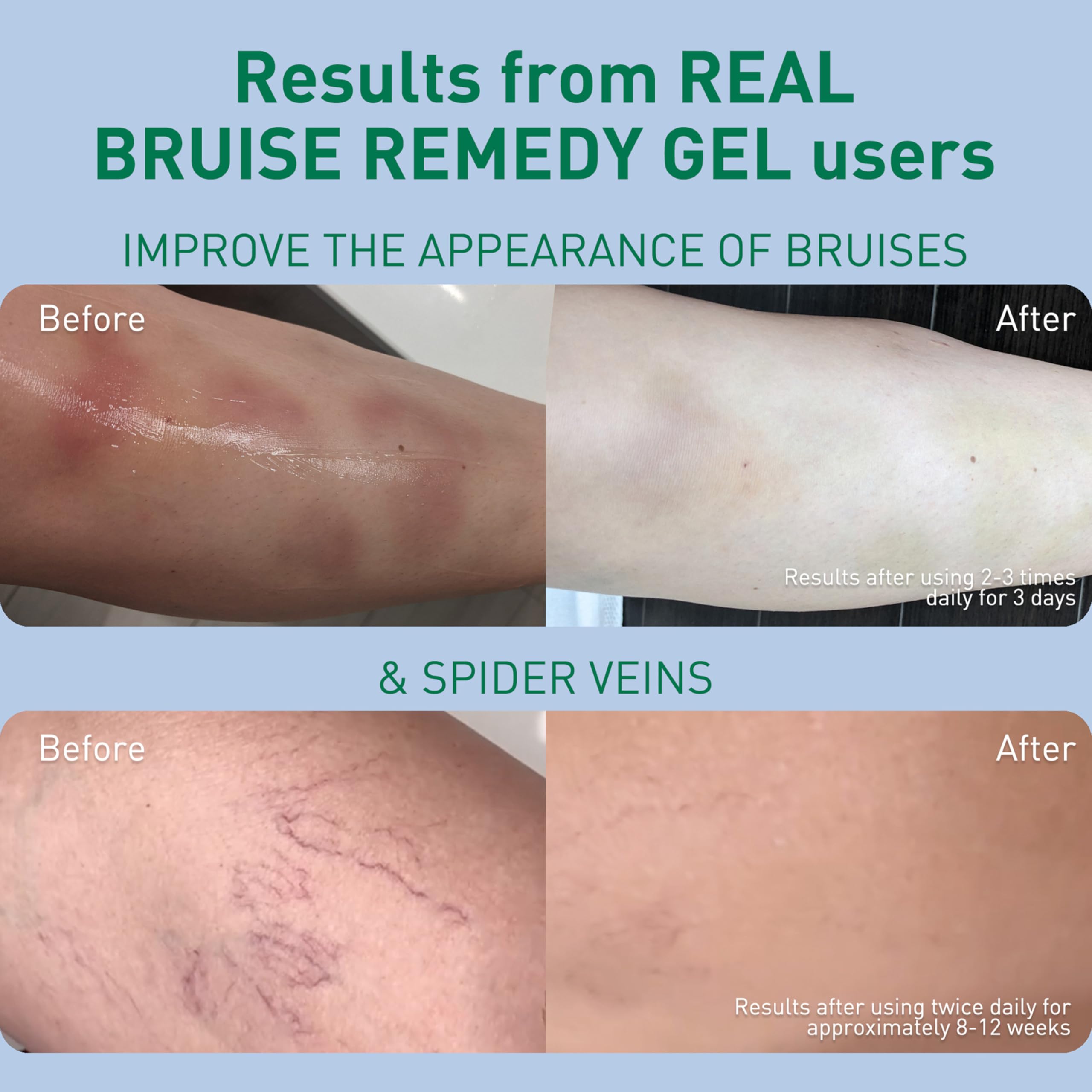 PROcure Arnica & MSM Bruise Remedy Gel – Paraben-Free, Unscented Arnica Montana Gel for Bruising, Spider Veins & Skin Discoloration – 2 Pack PROcure Au supplements