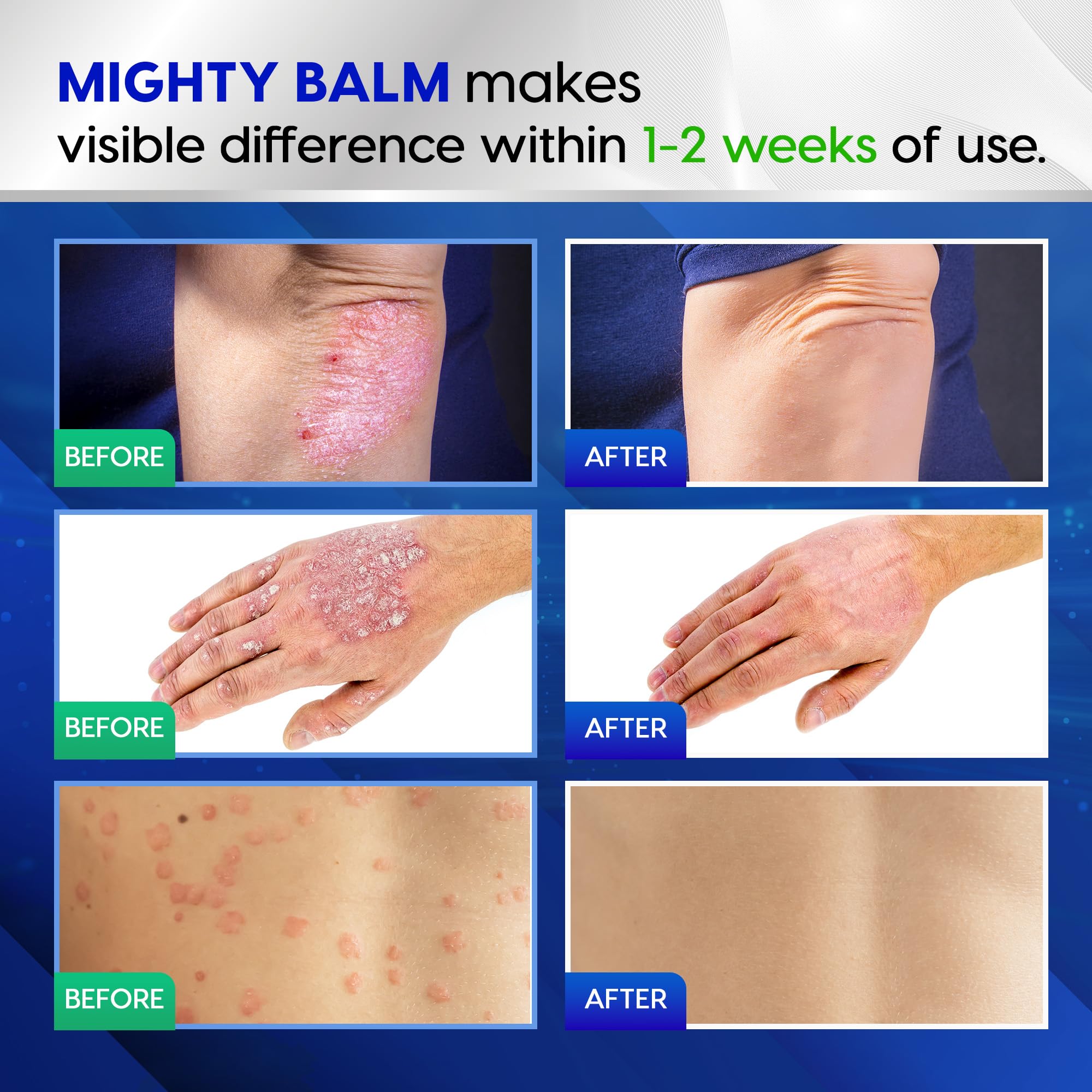 Tobcharm Antifungal Cream, Antifungal Cream for Skin, Ringworm Treatment for Humans Tobcharm Au supplements