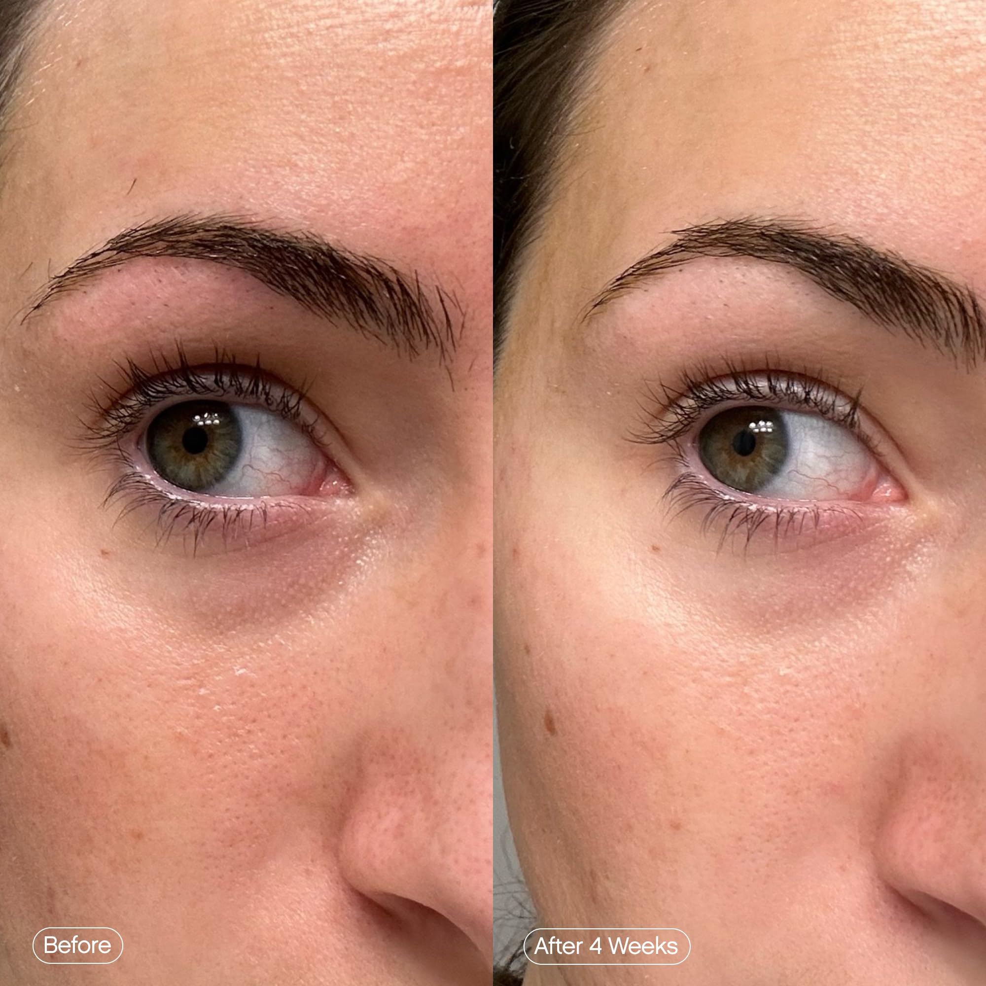 Topicals Faded Brightening Under Eye Masks | Patches to Depuff, Hydrate, Brighten and Cool | Reduce Dark Circles and Fine Lines | Contains Kojic Acid, Caffeine and Niacinamide (Set of 6) Topicals Au supplements