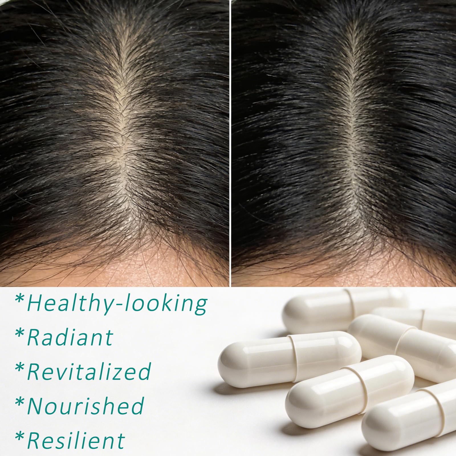 Hair Growth Biotin 10000mcg Supplement with Vitamins A C D E & Calcium - 30-in-1 Formula for Hair & Nails Support, for Women & Men, 30 Servings (1) WOJJ Au supplements