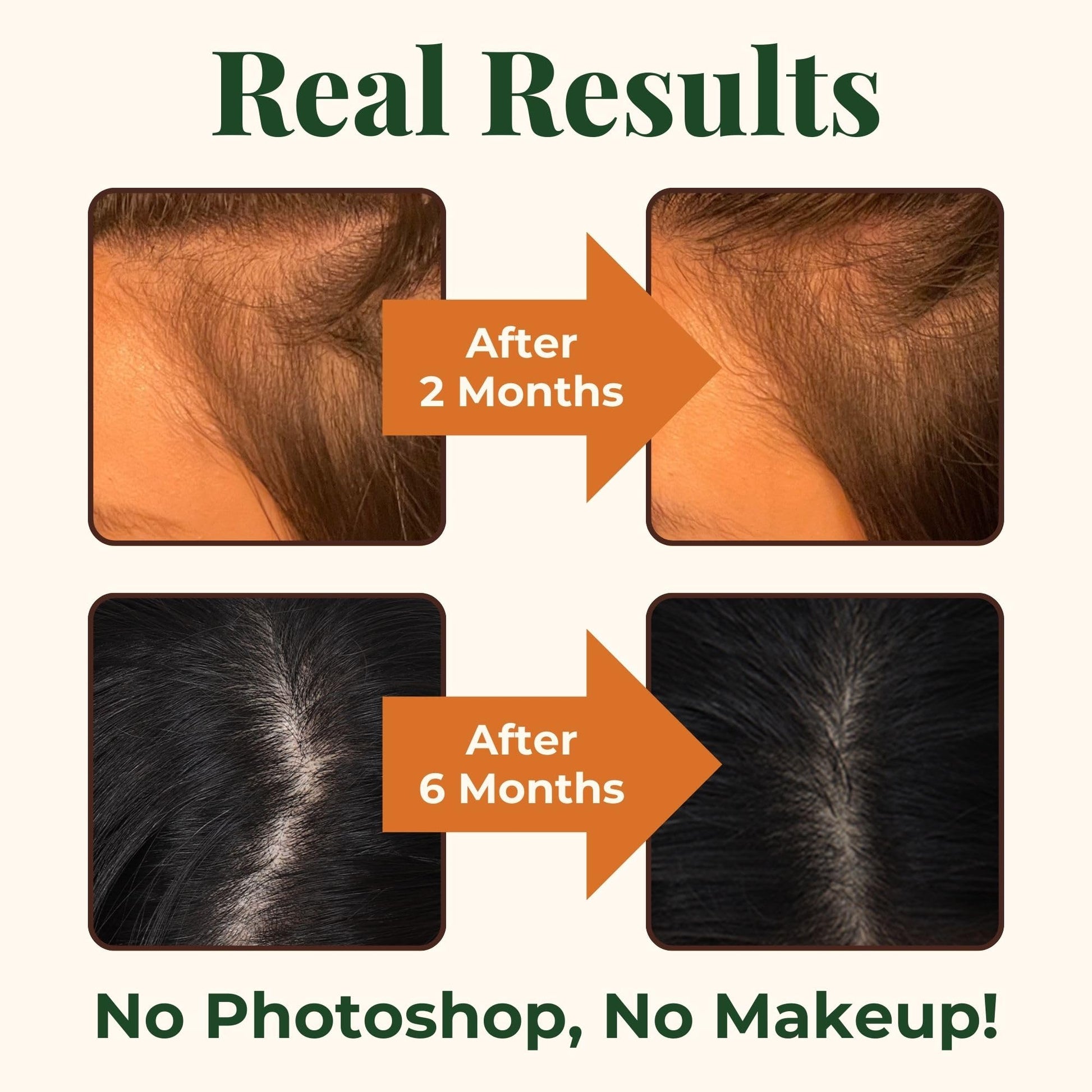 Heebin's Royal Hair, Brows & Lashes, Hair Growth Vitamins with Biotin 4000 mcg, Collagen Heebin's Au supplements