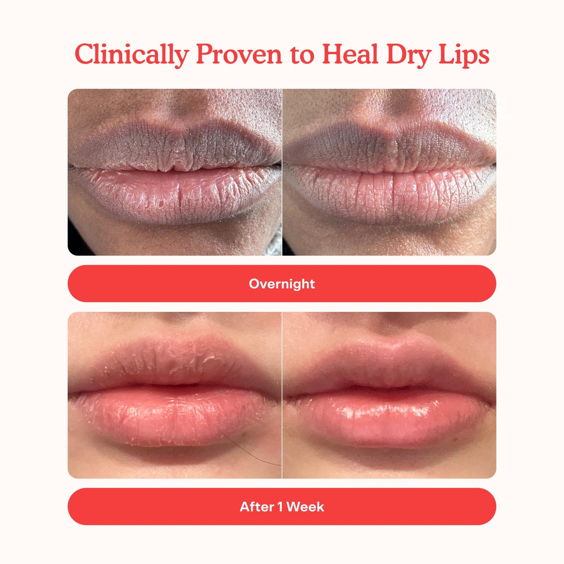 Tower 28 LipSoftie Tinted Lip Balm Treatment - Hydrating Glossy Balm + Overnight Lip Mask with Jojoba Oil + Shea Butter - Sweet, Cushiony Formula for Smooth, Soft Lips - Watermelon Kiwi (0.38 oz) Tower 28 Au supplements