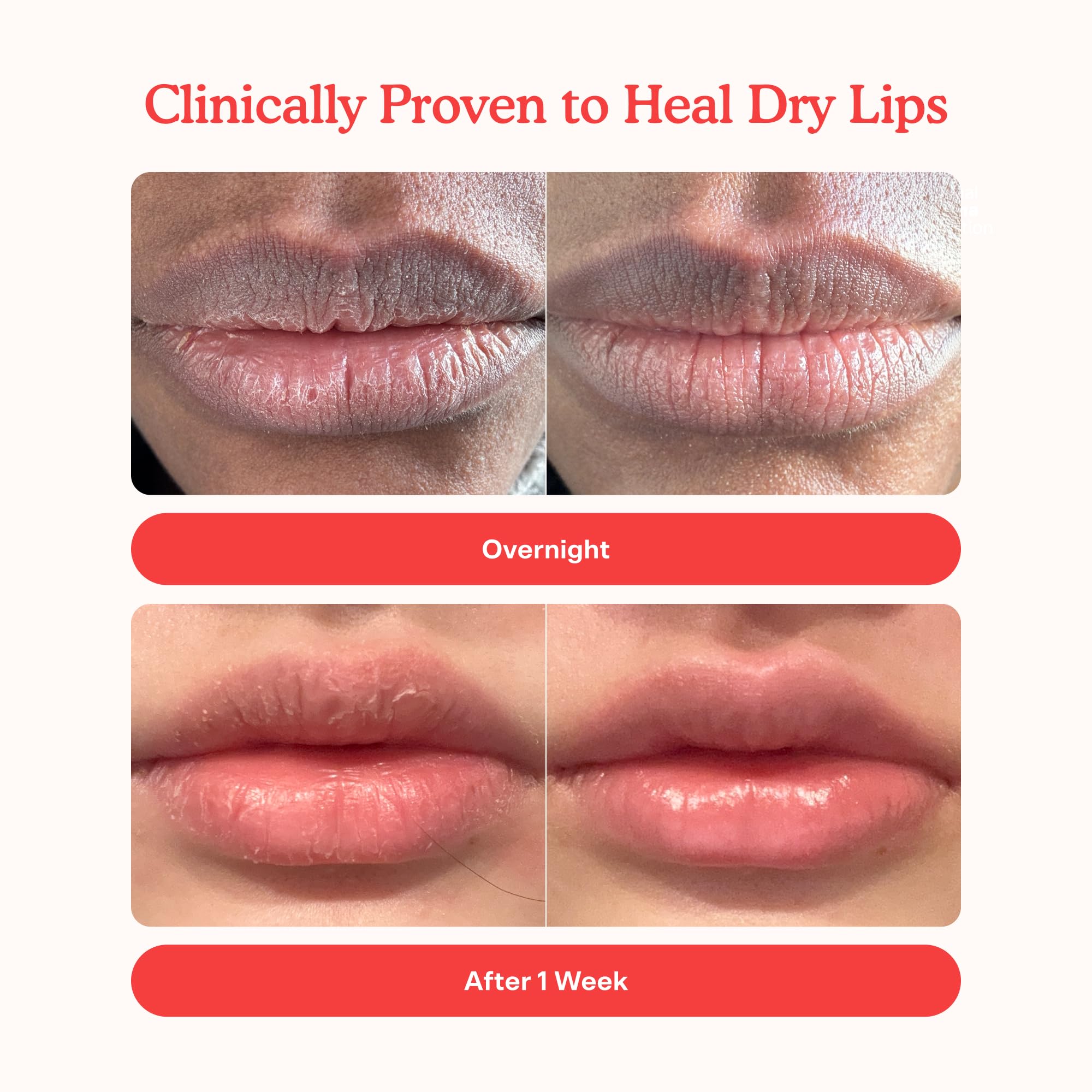 Tower 28 LipSoftie Tinted Lip Balm Treatment - Hydrating Glossy Balm + Overnight Lip Mask with Jojoba Oil + Shea Butter - Sweet, Cushiony Formula for Smooth, Soft Lips - Watermelon Kiwi (0.38 oz) Tower 28 Au supplements