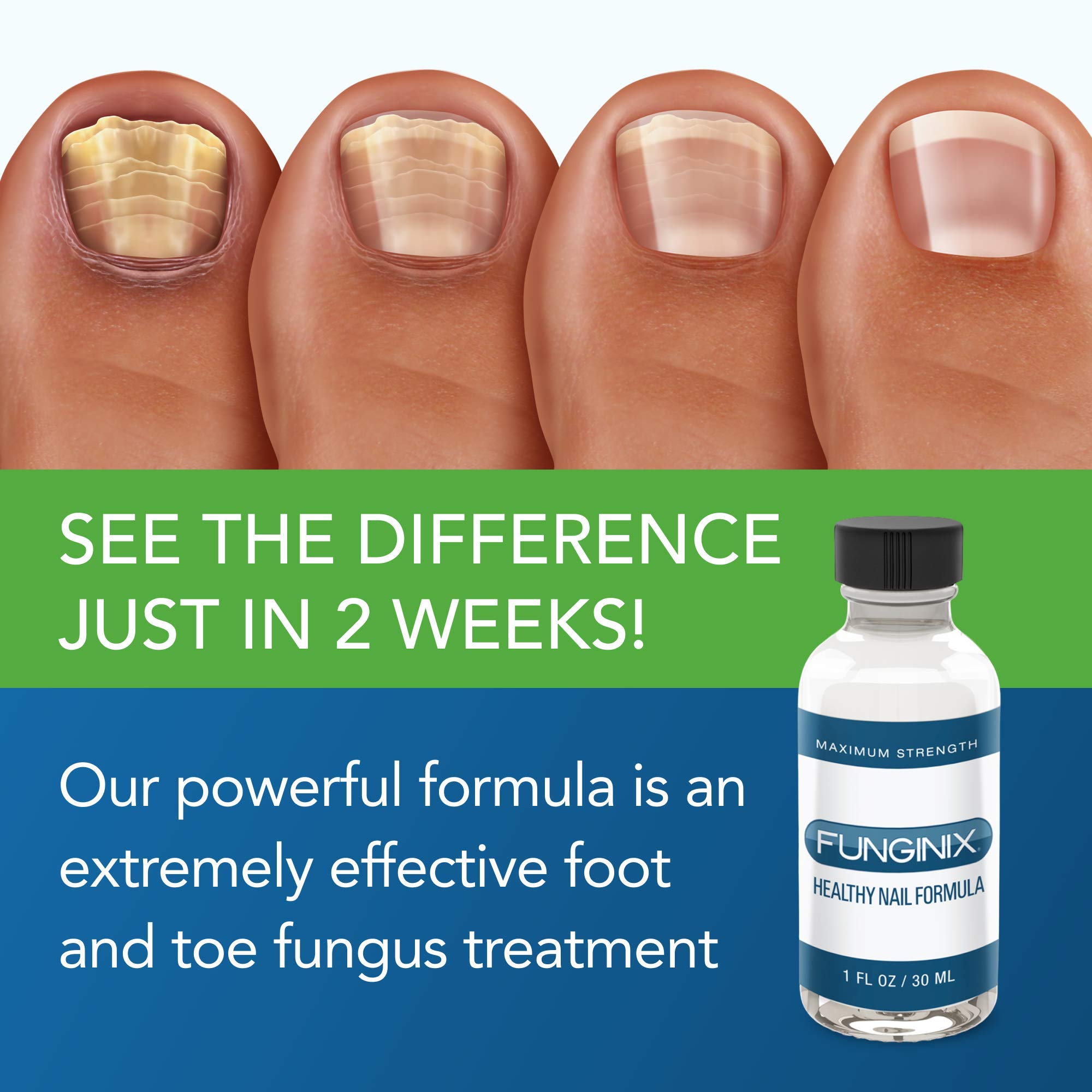 FUNGINIX Healthy Nail Formula - Finger And Toe Fungus Treatment, Made In USA, Foot FUNGINIX Au supplements
