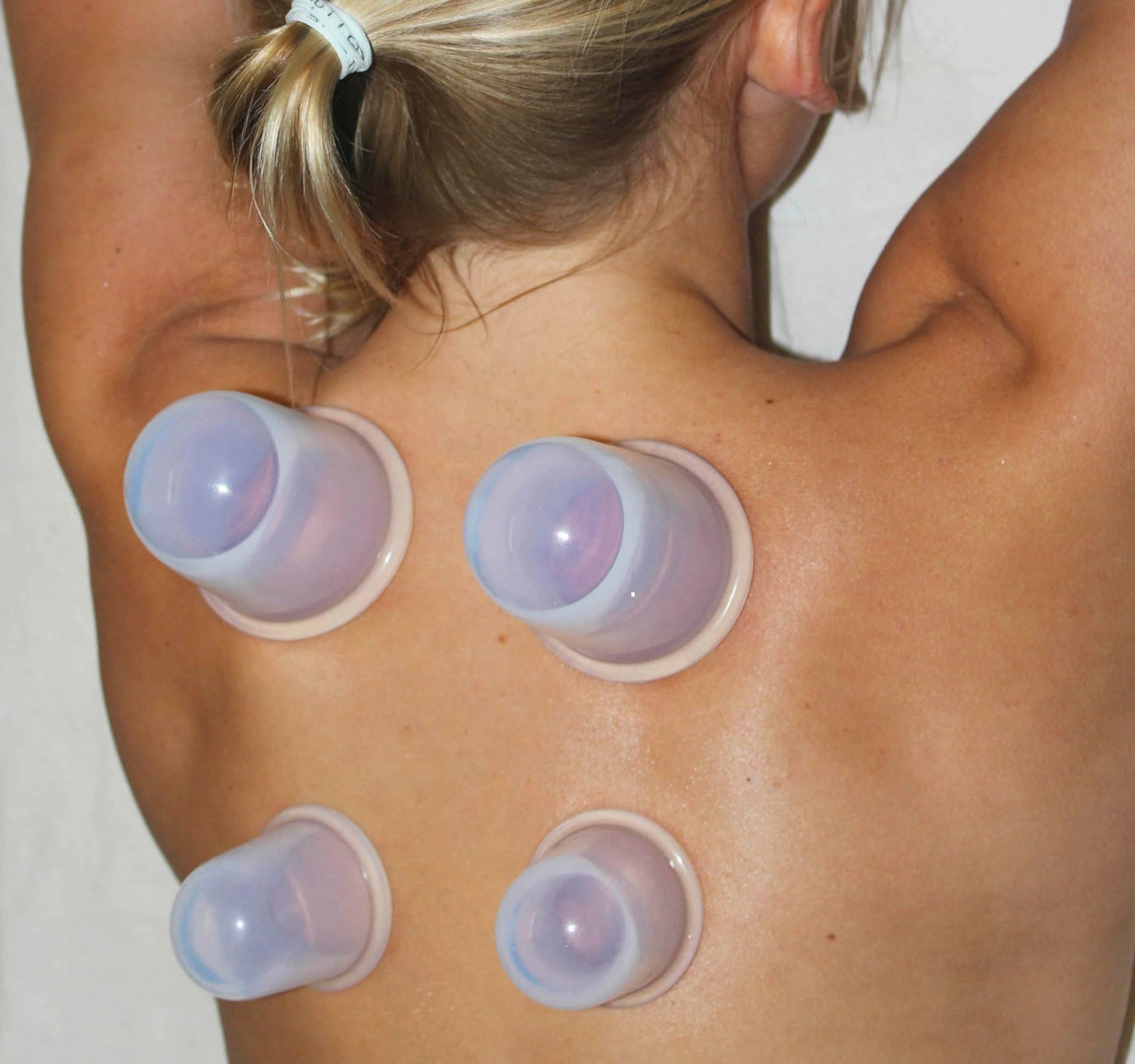 Cupping Kit for Massage Therapy - by DoSensePro, Cupping Set of 6 Professional Silicone Cups DoSensePro Au supplements