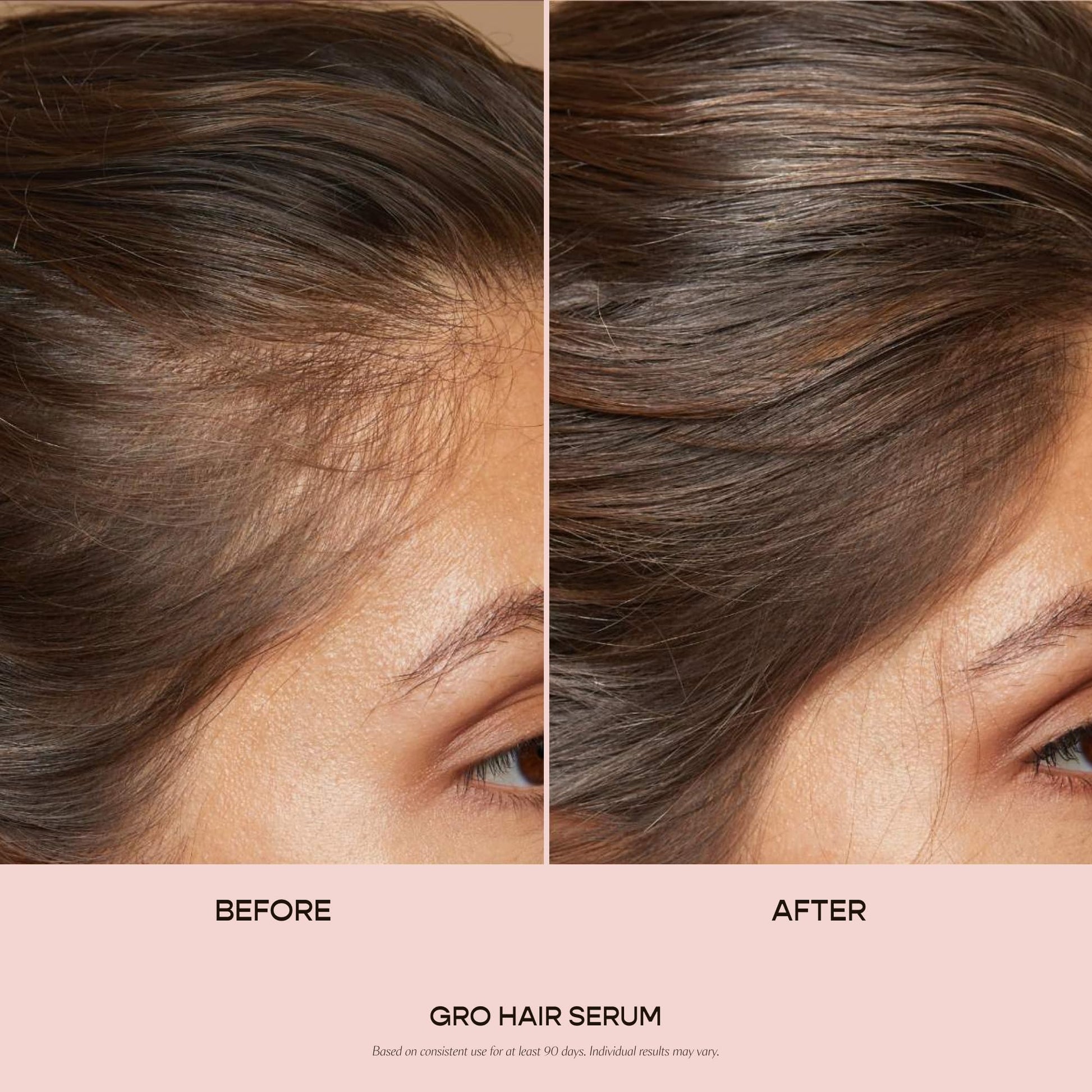 VEGAMOUR GRO Hair Serum for Hair Thinning, Thicker Fuller Looking Hair, Non Oily Tonic, 3 pack, 90 day supply VEGAMOUR Au supplements