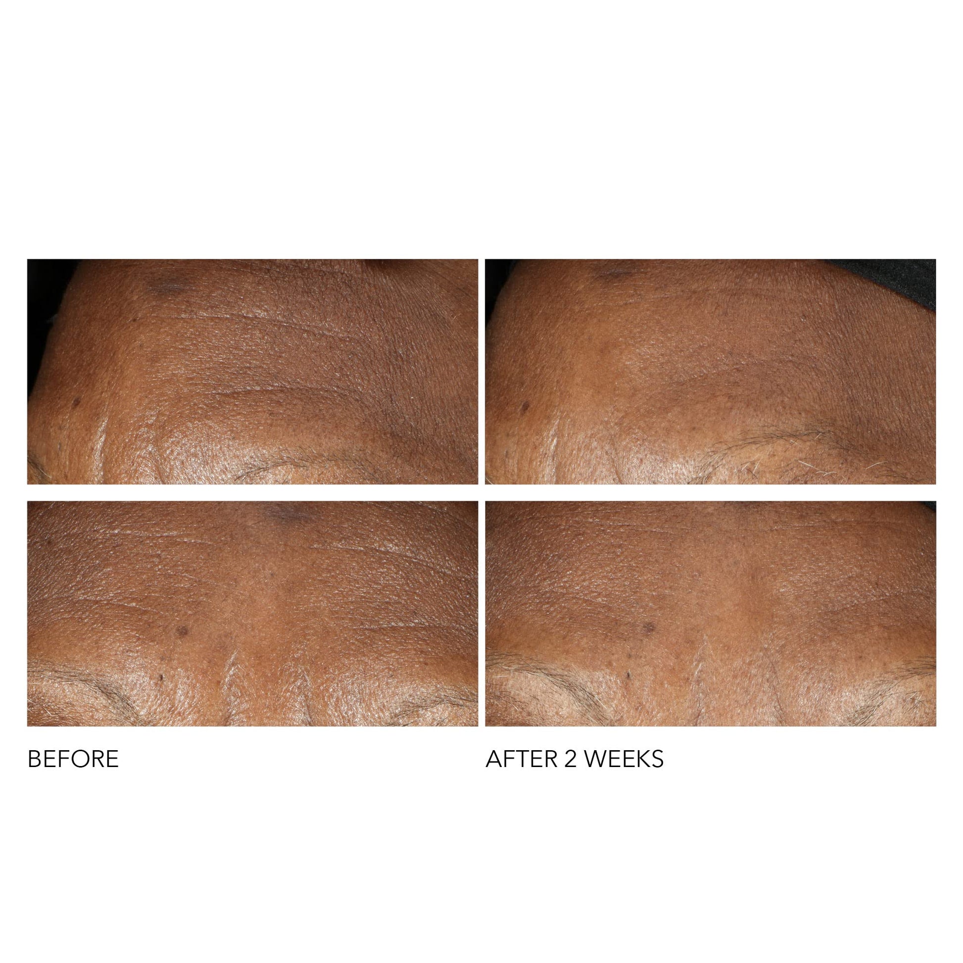 Dr Dennis Gross Advanced Retinol + Ferulic Intense Wrinkle Cream | Intensely Hydrating to Visibly Transform Skin and Repair the Moisture Barrier | 2 oz Dr Dennis Gross Au supplements