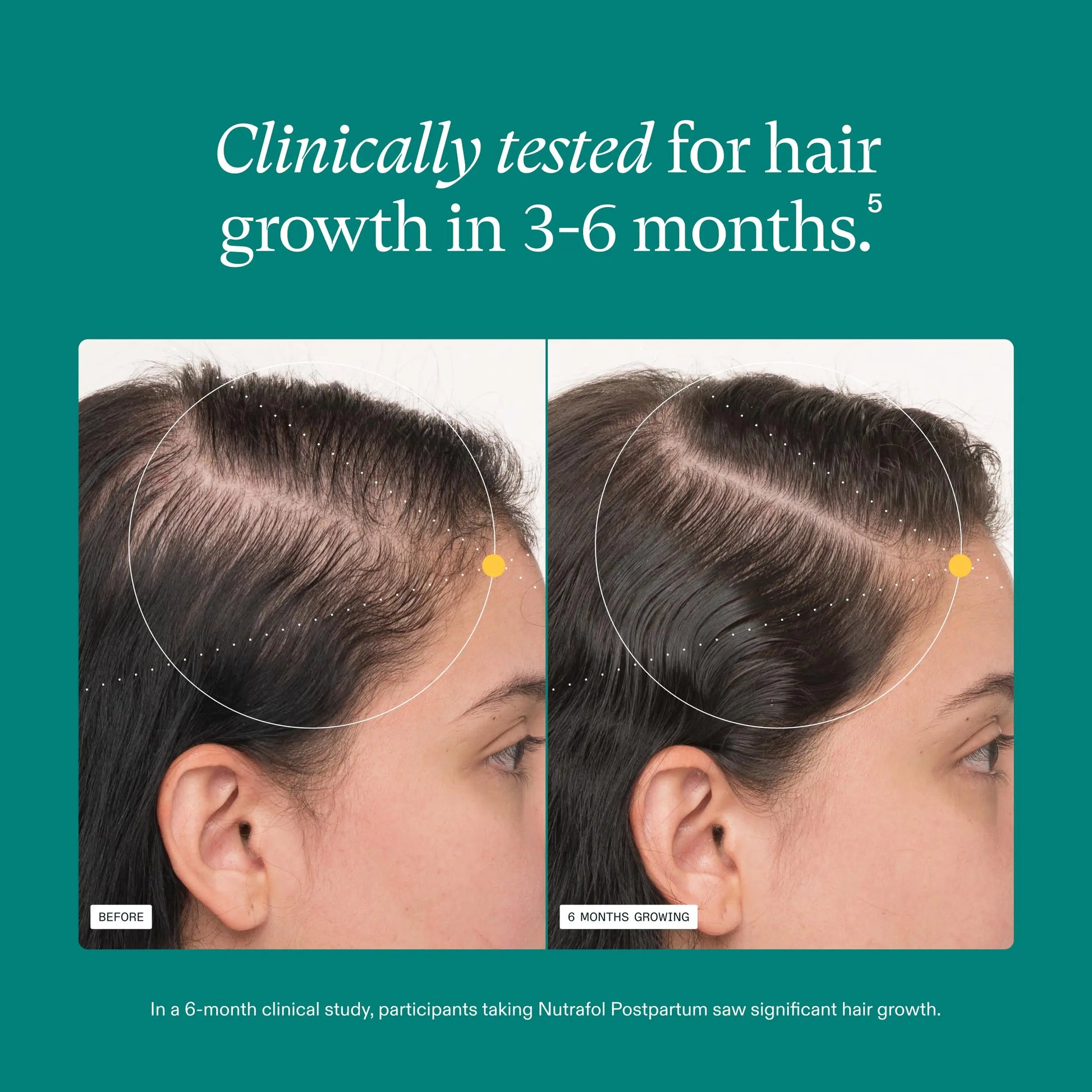 Nutrafol Postpartum Hair Growth Supplements, Clinically Tested for Visibly Thicker Hair and Less Shedding, Breastfeeding-friendly - 1 Month Supply Nutrafol Au supplements