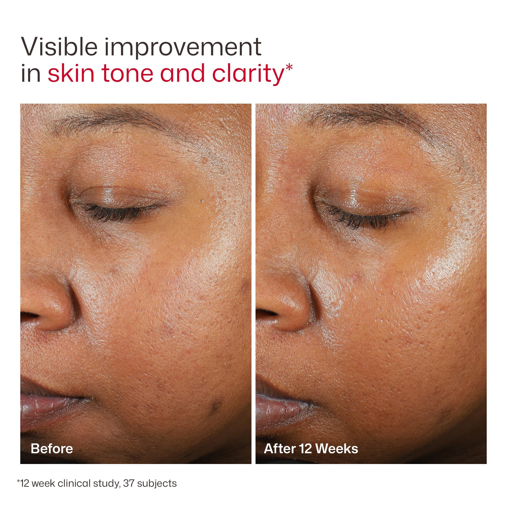 EltaMD UV Clear Tinted Sunscreen for Face, SPF 46 with Zinc Oxide, Oil-Free, Dermatologist Recommended, For Acne-Prone Sensitive Skin, 1.7 oz EltaMD Au supplements
